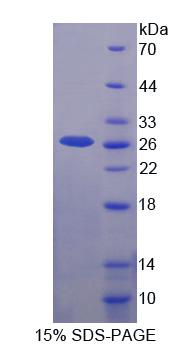 尿溶蛋白3A(UPK3A)重組蛋白,Recombinant Uroplakin 3A (UPK3A)