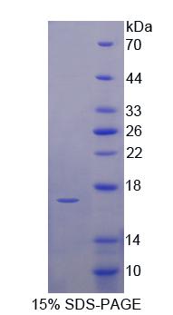 尿溶蛋白1A(UPK1A)重组蛋白,Recombinant Uroplakin 1A (UPK1A)