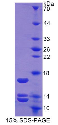 尿皮质素2(UCN2)重组蛋白,Recombinant Urocortin 2 (UCN2)