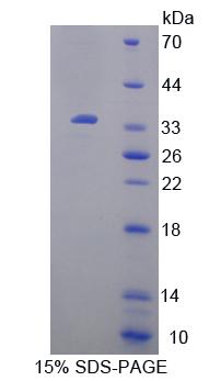 尿嘧啶核苷磷酸化酶1(UPP1)重组蛋白,Recombinant Uridine Phosphorylase 1 (UPP1)