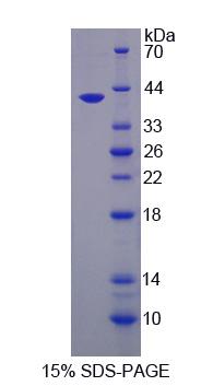 尿嘧啶DNA糖基化酶(UNG)重组蛋白,Recombinant Uracil DNA Glycosylase (UNG)