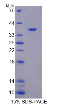 鸟氨酸转氨酶(OAT)重组蛋白,Recombinant Ornithine Aminotransferase (OAT)