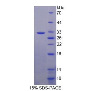 前蛋白转化酶枯草溶菌素9(PCSK9)重组蛋白
