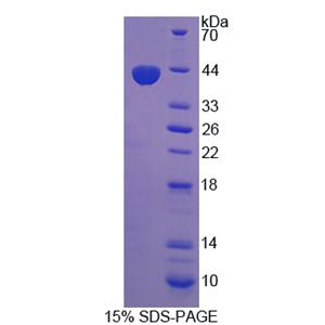 前蛋白转化酶枯草溶菌素5(PCSK5)重组蛋白