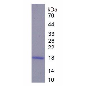 前蛋白转化酶枯草溶菌素2(PCSK2)重组蛋白