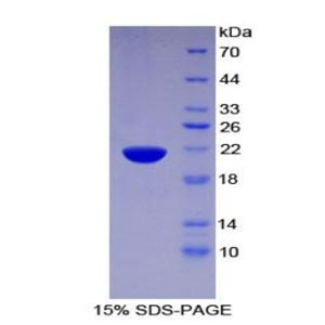 普列克底物蛋白同源物样域家族A成员2(PHLDA2)重组蛋白