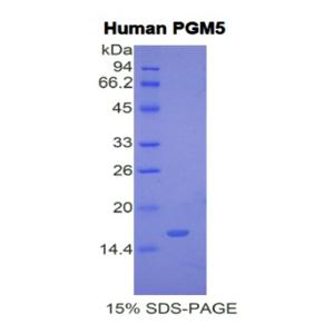 葡萄糖磷酸变位酶5(PGM5)重组蛋白