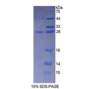 葡萄糖磷酸变位酶1(PGM1)重组蛋白,Recombinant Phosphoglucomutase 1 (PGM1)