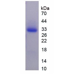 葡萄糖6磷酸異構(gòu)酶(GPI)重組蛋白,Recombinant Glucose 6 Phosphate Isomerase (GPI)