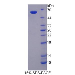 葡萄糖6磷酸脱氢酶(G6PD)重组蛋白,Recombinant Glucose-6-phosphate Dehydrogenase (G6PD)