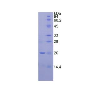 皮质醇结合球蛋白(CBG)重组蛋白,Recombinant Corticosteroid Binding Globulin (CBG)