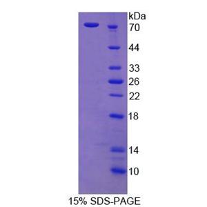 皮层肌动蛋白(CTTN)重组蛋白,Recombinant Cortactin (CTTN)