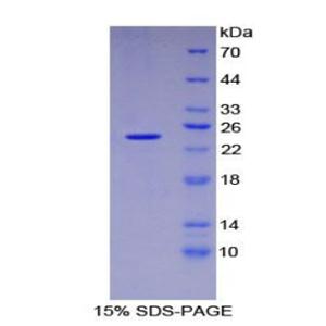 蓬乱蛋白Dsh同源物1(DVL1)重组蛋白