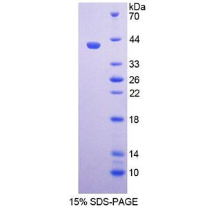 配对框基因9(PAX9)重组蛋白