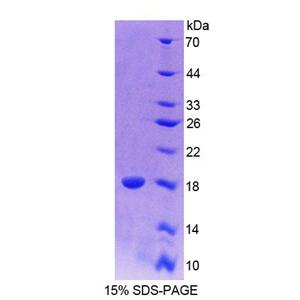 配对框基因6(PAX6)重组蛋白