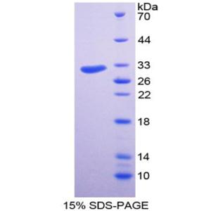 盘状结构域受体家族成员2(DDR2)重组蛋白