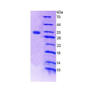 凝血因子ⅩⅢA1肽(F13A1)重组蛋白,Recombinant Coagulation Factor XIII A1 Polypeptide (F13A1)