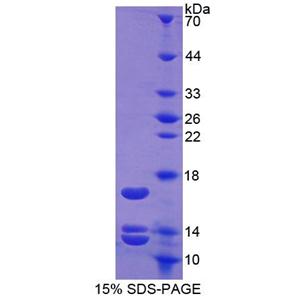 尿皮质素2(UCN2)重组蛋白,Recombinant Urocortin 2 (UCN2)