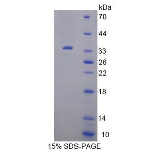 尿嘧啶核苷磷酸化酶1(UPP1)重组蛋白