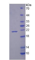 尼克酰胺腺嘌呤二核苷酸磷酸氧化酶4(NOX4)重组蛋白,Recombinant NADPH Oxidase 4 (NOX4)