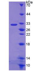 尼克酰胺腺嘌呤二核苷酸磷酸氧化酶3(NOX3)重组蛋白,Recombinant Nicotinamide Adenine Dinucleotide Phosphate Oxidase 3 (NOX3)