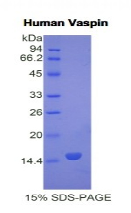 内脏脂肪特异性丝氨酸蛋白酶抑制因子(Vaspin)重组蛋白,Recombinant Visceral Adipose Tissue Derived Serine Protease Inhibitor (Vaspin)