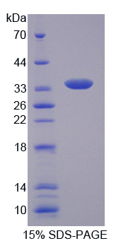 内切核酸酶G(ENDOG)重组蛋白,Recombinant Endonuclease G, Mitochondrial (ENDOG)