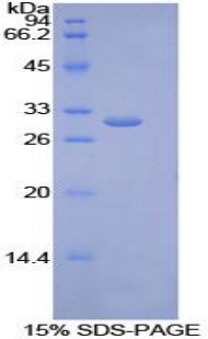 内皮脂肪酶(LIPG)重组蛋白,Recombinant Lipase, Endothelial (LIPG)