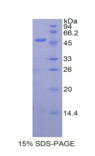 内皮抑素(ES)重组蛋白,Recombinant Endostatin (ES)