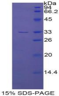 内皮素转化酶1(ECE1)重组蛋白,Recombinant Endothelin Converting Enzyme 1 (ECE1)