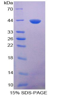 脑钠素(BNP)重组蛋白,Recombinant Brain Natriuretic Peptide (BNP)