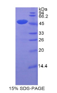 脑多巴胺神经营养因子(CDNF)重组蛋白,Recombinant Cerebral Dopamine Neurotrophic Factor (CDNF)