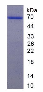 囊性纖維化跨膜傳導(dǎo)調(diào)節(jié)因子(CFTR)重組蛋白,Recombinant Cystic Fibrosis Transmembrane Conductance Regulator (CFTR)