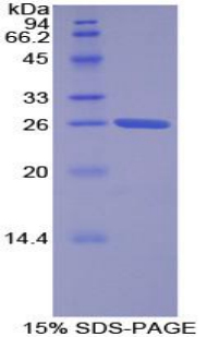 耐扭蛋白2A(TOR2A)重组蛋白,Recombinant Torsin 2A (TOR2A)