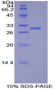 耐扭蛋白1B(TOR1B)重组蛋白,Recombinant Torsin 1B (TOR1B)