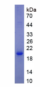 钠/葡萄糖协同转运蛋白1(SGLT1)重组蛋白,Recombinant Sodium/Glucose Cotransporter 1 (SGLT1)