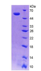 墨蝶呤还原酶(SPR)重组蛋白,Recombinant Sepiapterin Reductase (SPR)