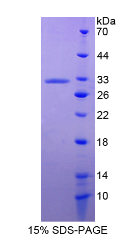 膜联蛋白A6(ANXA6)重组蛋白,Recombinant Annexin A6 (ANXA6)