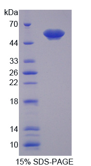 膜联蛋白A11(ANXA11)重组蛋白,Recombinant Annexin A11 (ANXA11)