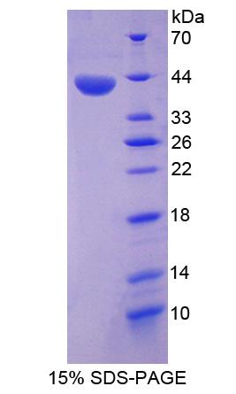 膜联蛋白A10(ANXA10)重组蛋白,Recombinant Annexin A10 (ANXA10)