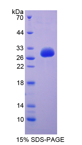 免疫球蛋白超家族成员2(IGSF2)重组蛋白,Recombinant Immunoglobulin Superfamily, Member 2 (IGSF2)