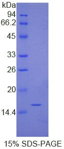 免疫球蛋白G4(IgG4)重组蛋白,Recombinant Immunoglobulin G4 (IgG4)