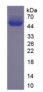 免疫球蛋白E(IgE)重组蛋白,Recombinant Immunoglobulin E (IgE)