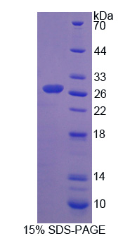 糜蛋白酶原B1(CTRB1)重组蛋白,Recombinant Chymotrypsinogen B1 (CTRB1)