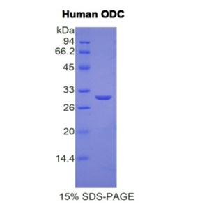 鸟氨酸脱羧酶(ODC)重组蛋白