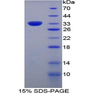 黏病毒耐药蛋白1(MX1)重组蛋白