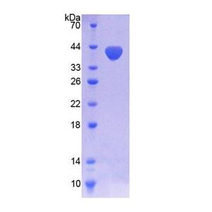 尼克酰胺腺嘌呤二核苷酸磷酸氧化酶5(NOX5)重组蛋白