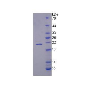 尼克酰胺腺嘌呤二核苷酸磷酸氧化酶4(NOX4)重组蛋白