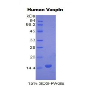 内脏脂肪特异性丝氨酸蛋白酶抑制因子(Vaspin)重组蛋白,Recombinant Visceral Adipose Tissue Derived Serine Protease Inhibitor (Vaspin)