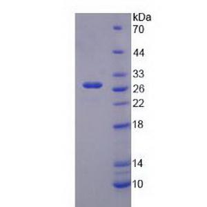 内向整流型钾离子通道亚家族J成员10(KCNJ10)重组蛋白,Recombinant Potassium Inwardly Rectifying Channel Subfamily J, Member 10 (KCNJ10)